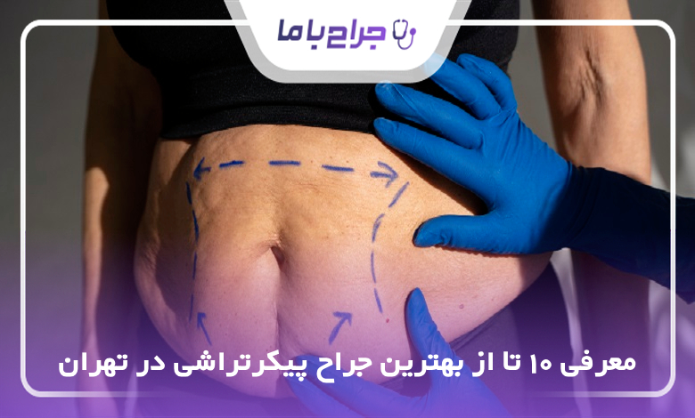 بهترین جراح پیکرتراشی در تهران