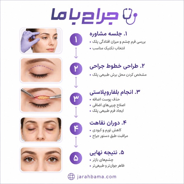 اشتباهات رایج هنگام انتخاب جراح بلفاروپلاستی