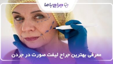بهترین جراح لیفت صورت در جردن