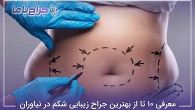 بهترین جراح زیبایی شکم در نیاوران