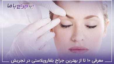 بهترین جراح بلفاروپلاستی در تجریش