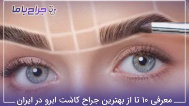 بهترین جراح کاشت ابرو در ایران