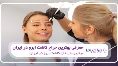 بهترین جراح کاشت ابرو در ایران