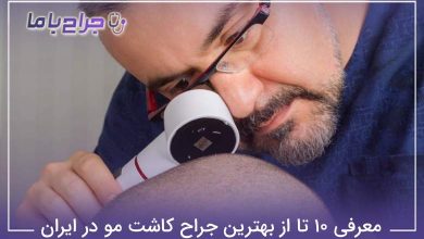 بهترین جراح کاشت مو در ایران