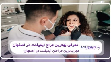 بهترین جراح ایمپلنت در اصفهان