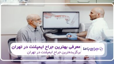 بهترین جراح ایمپلنت در تهران