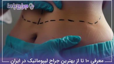 بهترین جراح لیپوماتیک در ایران
