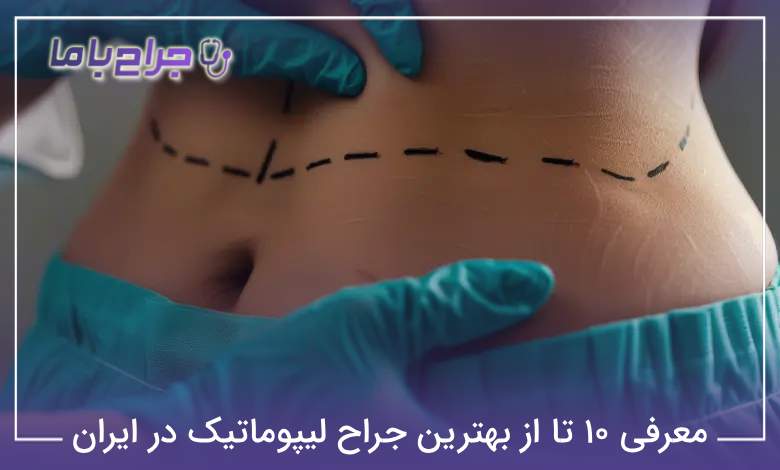 بهترین جراح لیپوماتیک در ایران