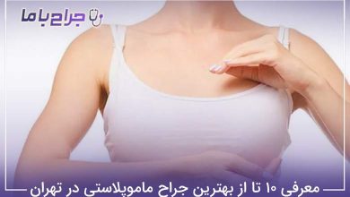 بهترین جراح ماموپلاستی در تهران