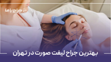 بهترین جراح لیفت صورت در تهران