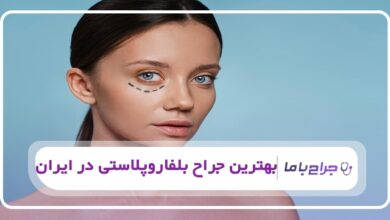 بهترین جراح بلفاروپلاستی در ایران