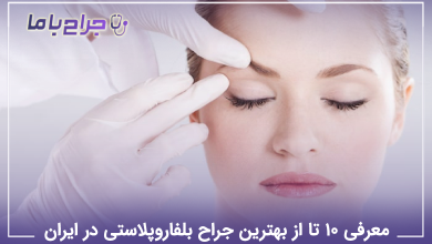 بهترین جراح بلفاروپلاستی در ایران