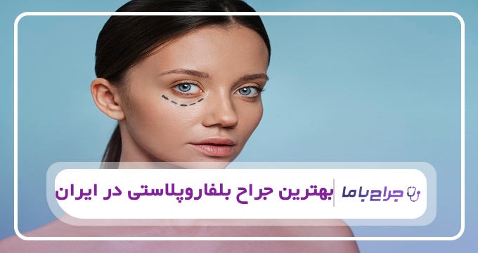 بهترین جراح بلفاروپلاستی در ایران