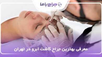 بهترین جراح کاشت ابرو در تهران