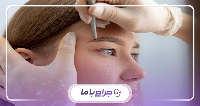 مراحل کاشت ابرو توسط بهترین جراحان کاشت ابروی تهران