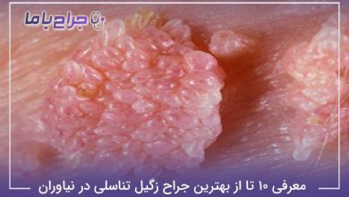 بهترین جراح زگیل تناسلی در نیاوران