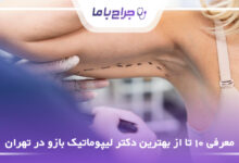 بهترین دکتر لیپوماتیک بازو در تهران