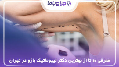 بهترین دکتر لیپوماتیک بازو در تهران