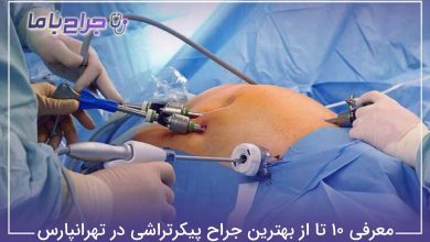 بهترین جراح پیکرتراشی در تهرانپارس
