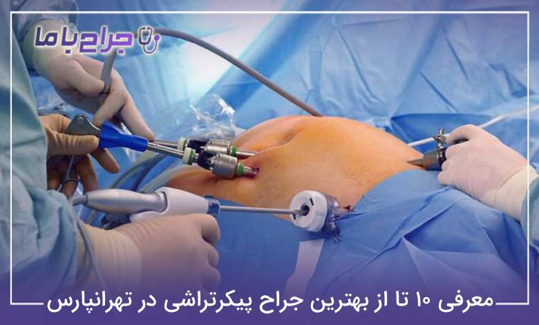 بهترین جراح پیکرتراشی در تهرانپارس