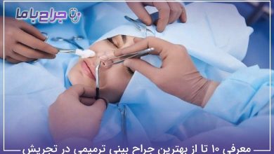 بهترین جراح بینی ترمیمی در تجریش