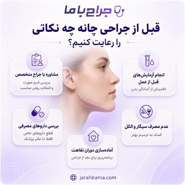ویژگیهای بهترین جراح چانه در تهران