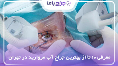 بهترین جراح آب مروارید در تهران
