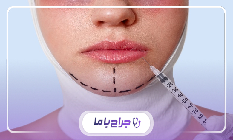 خدمات بهترین جراح چانه در تهران