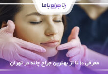 بهترین جراح چانه در تهران