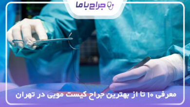 بهترین جراح کیست مویی در تهران