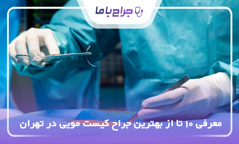 بهترین جراح کیست مویی در تهران