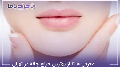 بهترین جراح چانه در تهران