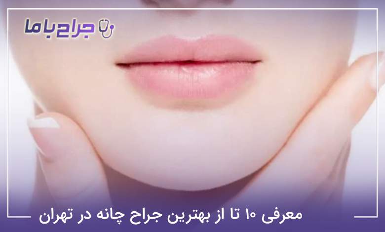 بهترین جراح چانه در تهران