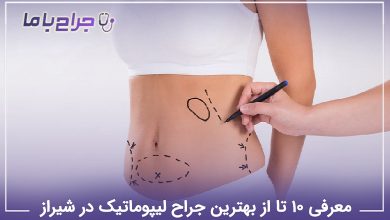 بهترین جراح لیپوماتیک در شیراز