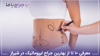 بهترین جراح لیپوماتیک در شیراز