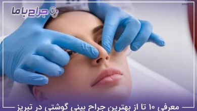 بهترین جراح بینی گوشتی در تبریز