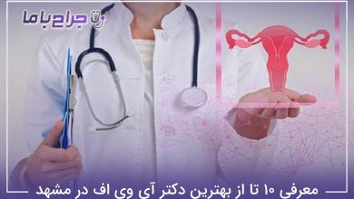 بهترین دکتر آی وی اف در مشهد