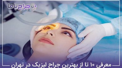 بهترین جراح لیزیک در تهران