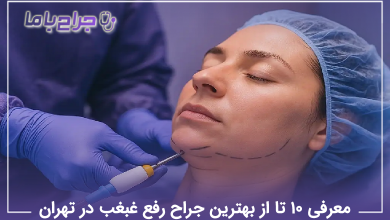 بهترین جراح رفع غبغب در تهران