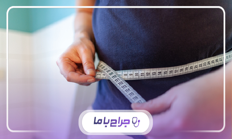 مراقبتهای بعد از عمل اسلیو معده توسط بهترین جراح