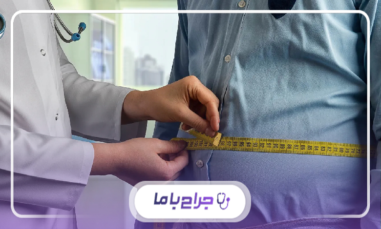معیارهای انتخاب بهترین جراح اسلیو معده در تهران