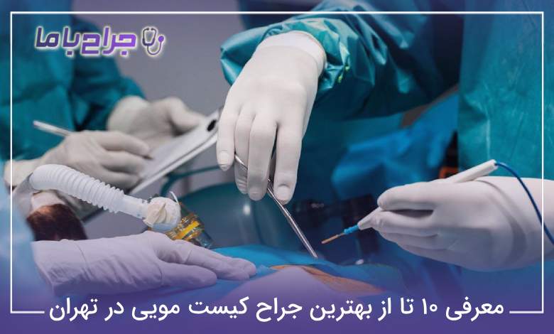 بهترین جراح کیست مویی در تهران