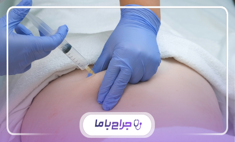 چگونه بهترین دکتر تزریق اوزون در تهران را انتخاب کنیم؟