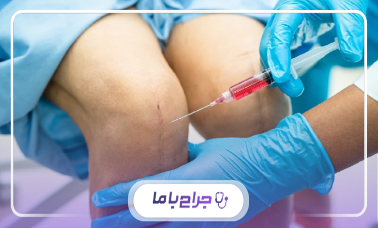 مراقبتهای قبل و بعد از تزریق اوزون در تهران