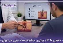 بهترین جراح کیست مویی در تهران