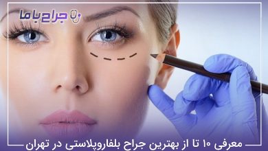 بهترین جراح بلفاروپلاستی در تهران
