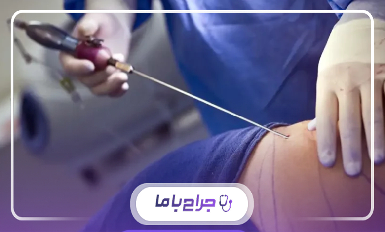 راهنمای جامع مراقبتهای بعد از جراحی