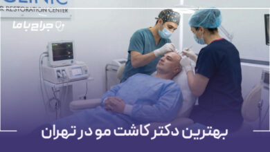 یهترین دکتر کاشت مو در تهران