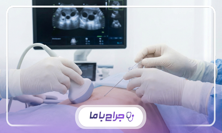 بهترین زمان برای جراحی آی وی اف چه زمانی است ؟