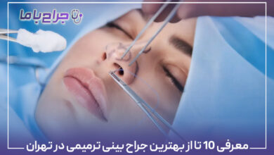 معرفی 10 تا از بهترین جراح بینی ترمیمی در تهران